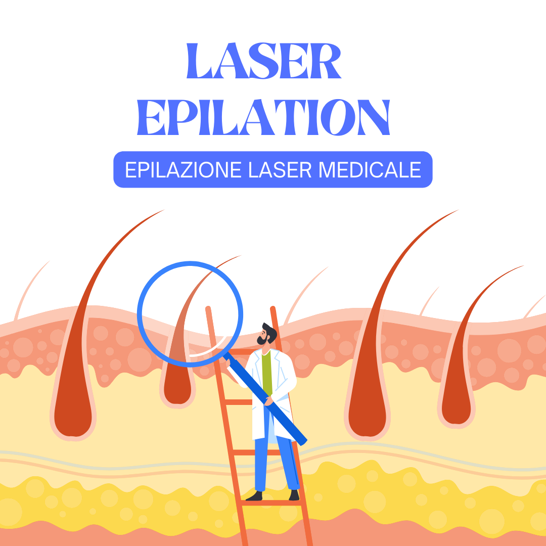 Laser Epilation