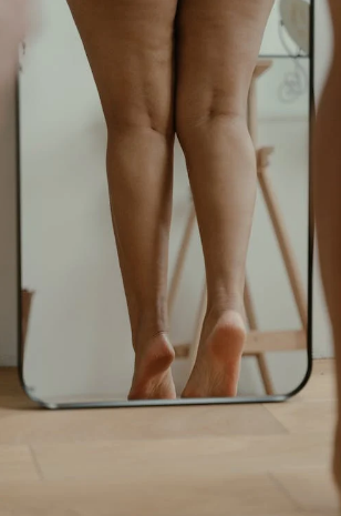 cellulite