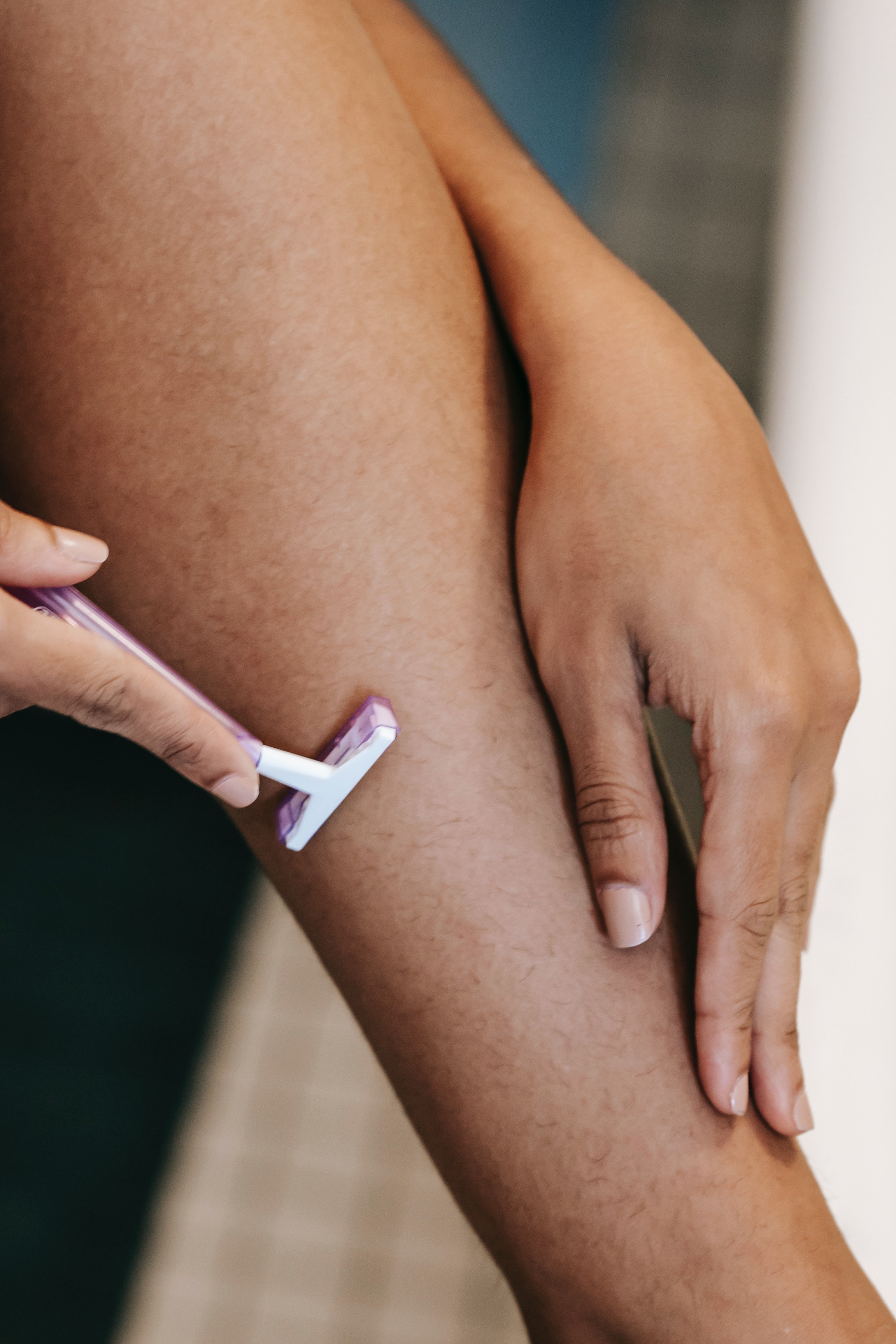 epilazione laser