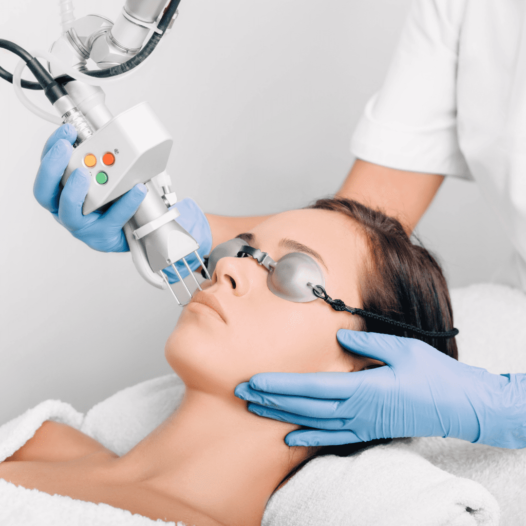 laser medicina estetica 1