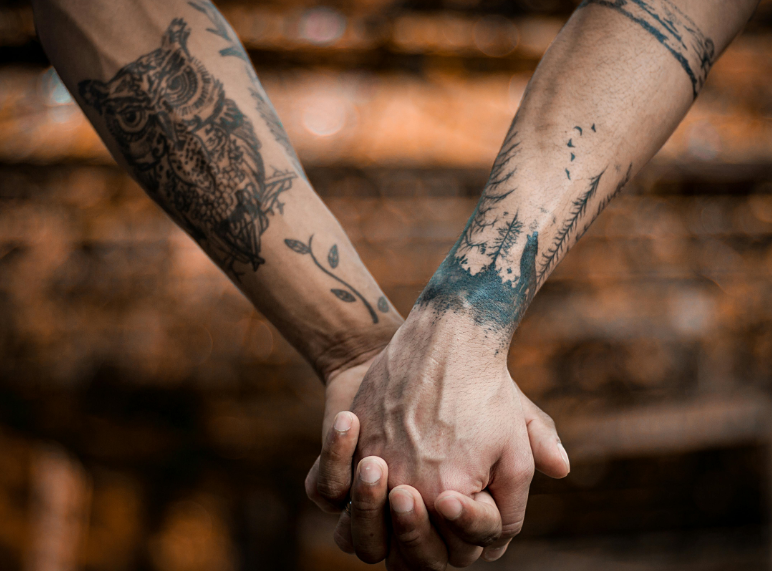 rimozione tatoo